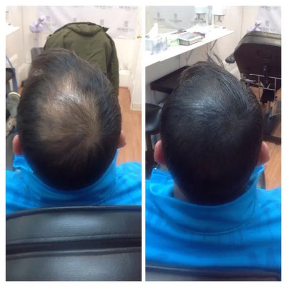 The Garnish Hair Growth Oil