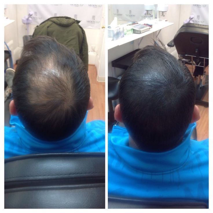 The Garnish Hair Growth Oil