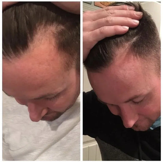 The Garnish Hair Growth Oil